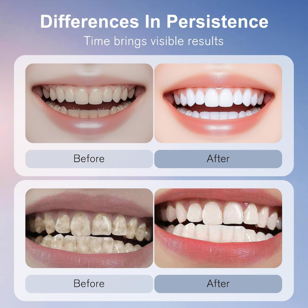 Glysi BrightSmile Toothpaste™